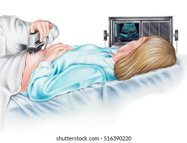 Ultrasonogram
